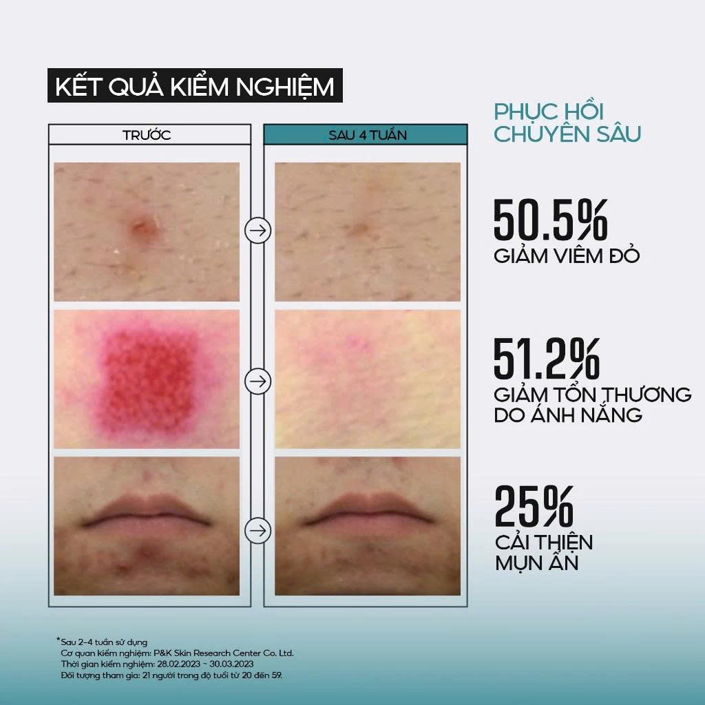 Tinh chất dưỡng da Ốc sên giúp ngăn ngừa lão hóa JUMISO Snail Mucin 95 + Peptide 140ml - Image 3